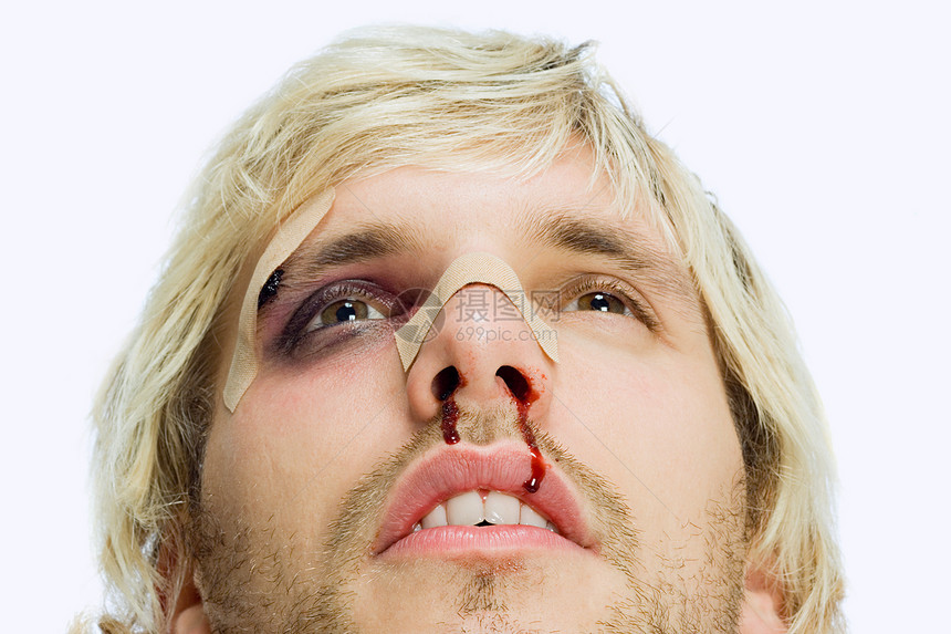 面部受伤的男人图片