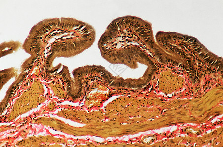 显微镜下的胆囊粘膜图片