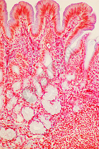 显微镜下的胃幽门区图片