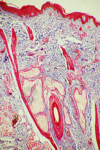 显微镜下的皮肤毛囊图片