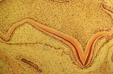 显微镜下发育中的牙齿图片