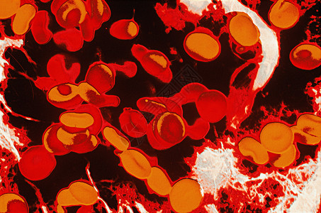 红细胞背景图片