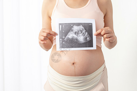 怀孕照片孕妇手拿宝宝b超照片背景