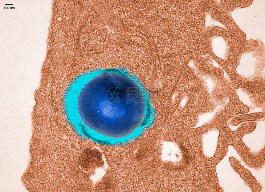 毒血球菌电子显微图图片