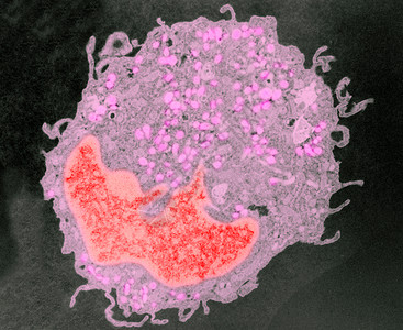 巨噬细胞电子显微图图片