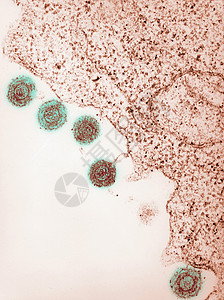 HHV6型人类疹6HHV电子显微图图片