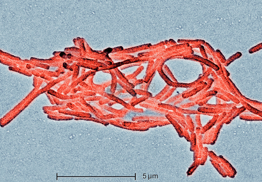 军团细菌电子显微图图片