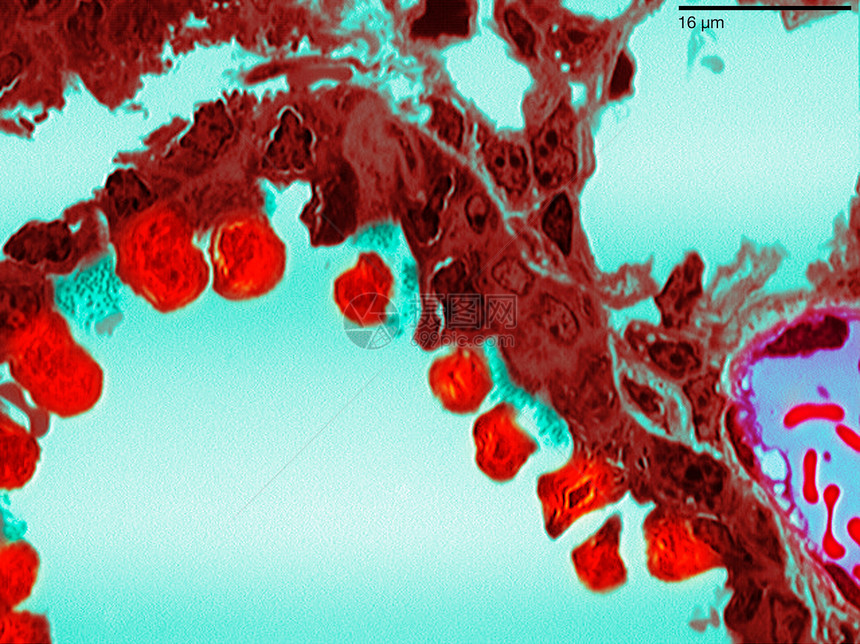支气管薄膜组织摄影图图片