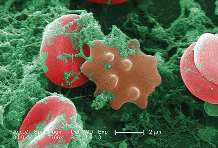 蛋白细胞红血细胞SEM背景