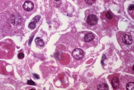 带有埃博拉的肝细胞轻型显微图图片