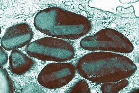 人类骨蛋白血细胞TEM图片