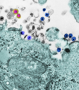 HTLVI和艾滋的TEM图片