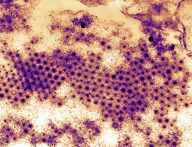 呼肠孤病毒3型透射电镜图背景图片