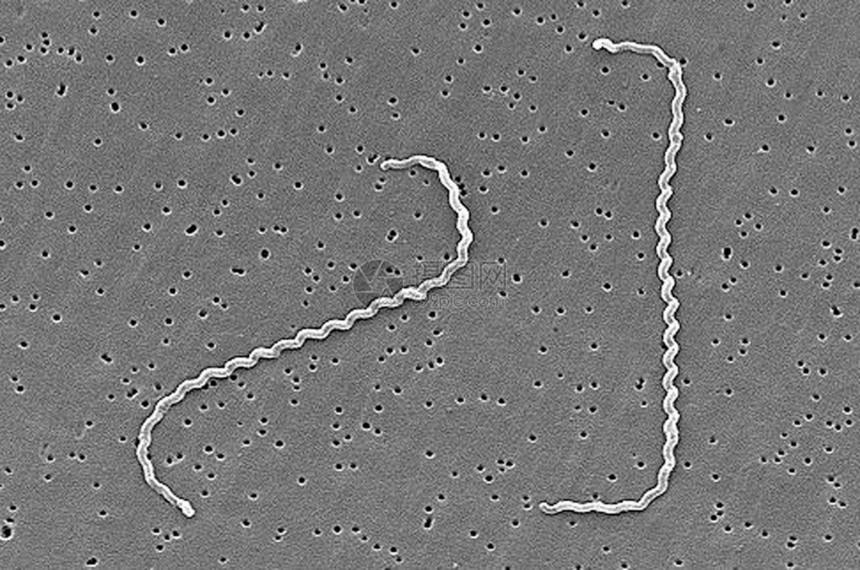 利普托斯皮拉细菌的SEM图片