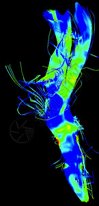 医学磁共振成像图片
