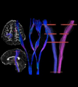 医学磁共振成像图片