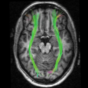 医学磁共振成像图片