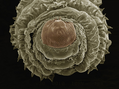 显微镜下的昆虫图片