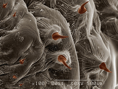 显微镜下的苍蝇幼虫图片