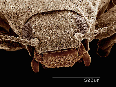 显微镜下的虫子图片