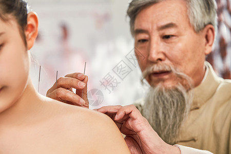人体皮肤在中医馆治疗的病人和中医背景