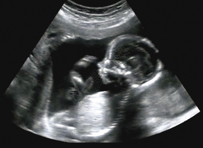 第四个月胎儿的超声波高清图片