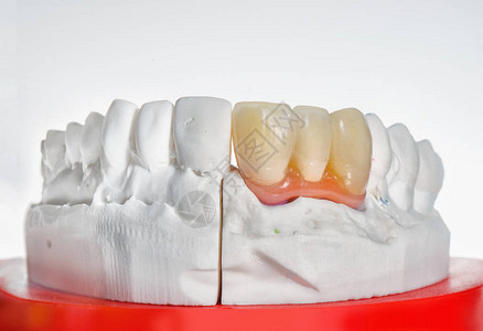 牙齿假牙和科假牙实验室模型的技术试镜图片