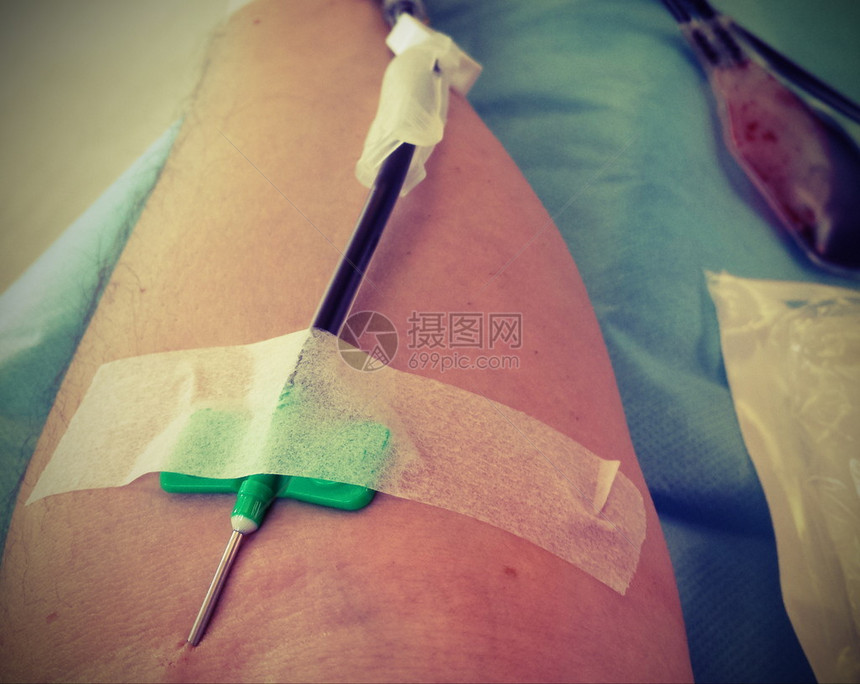 在医院用针头在手臂输血时图片