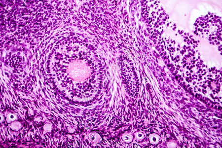 显示原始初级和二级囊泡的卵巢浅显微图背景图片