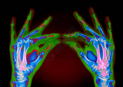 两只手的断层扫描模拟图像图片