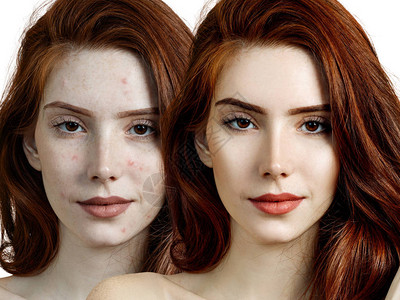 在皮肤治疗和化妆前后年背景图片