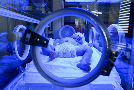新生儿在孵化器紫外光下接受黄蜂图片