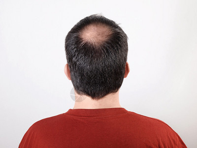 男头部头发或直发或高图片