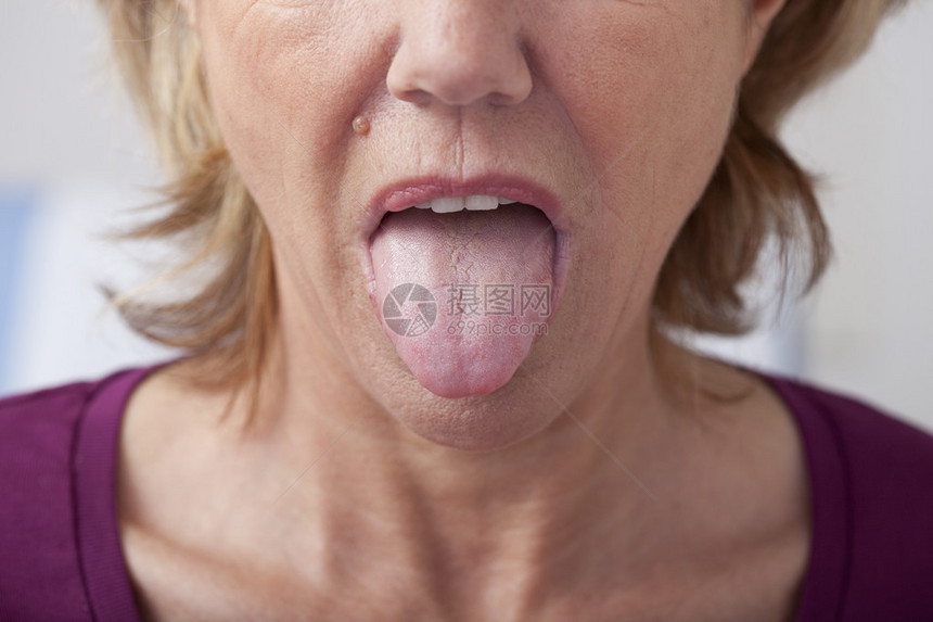 舌头图片
