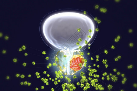 癌变前列腺癌原学的概念图3D插图显示感染前列腺并发设计图片
