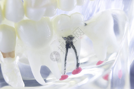 小樽运河牙根管牙医齿模型特写设计图片