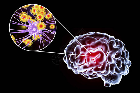 披帛3D插图显示大脑和突变神经元设计图片
