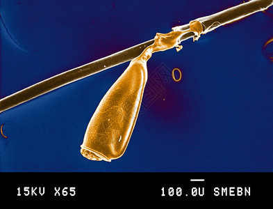 显微镜下的虱病图片