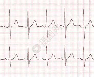背景网格上的心电图图片