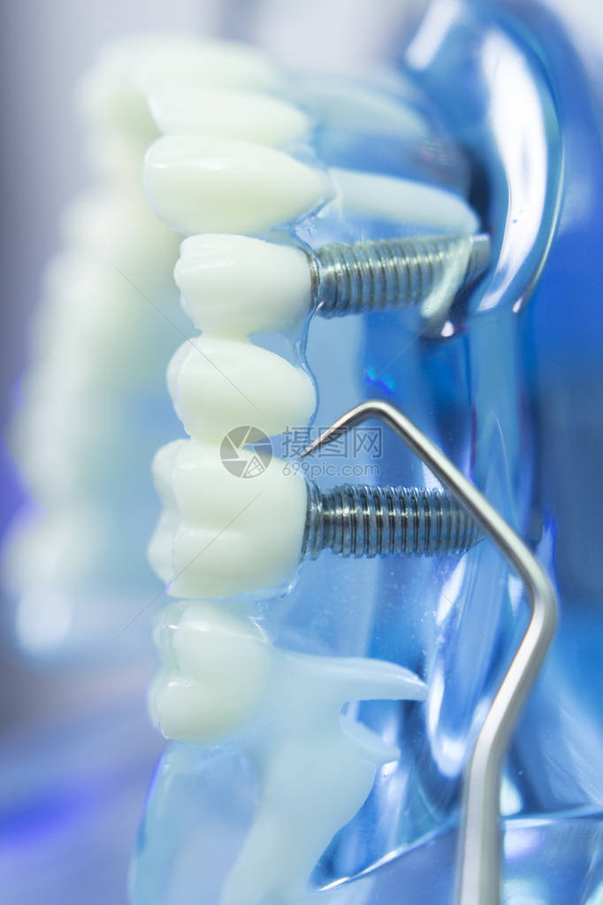 牙齿嘴牙龈医教学模型显示每颗牙齿和图片