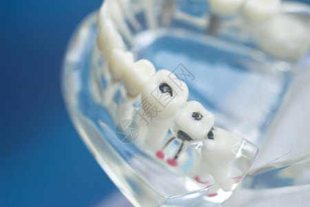 牙齿口腔牙医教学模型与牙齿牙龈图片