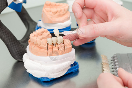 检查牙科化验室动脉中牙科图片