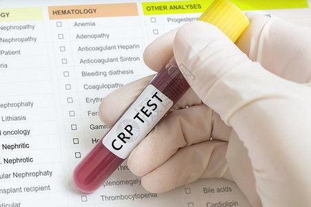 用血液测试管进行CRP检测以辨别病图片