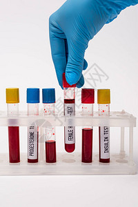 医生拿着女荷尔蒙测试管靠近血液样本站在白色图片
