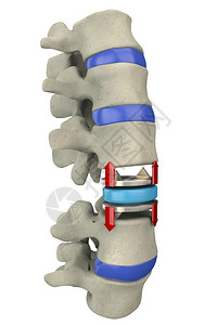 骨科医生人体脊柱部分的3d插图设计图片