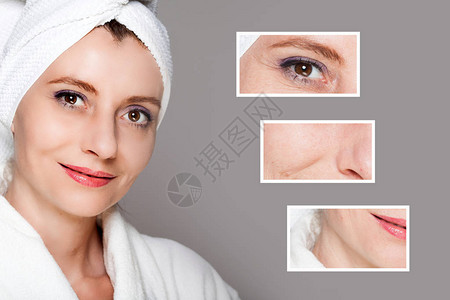 美容治疗后的快乐女人注射前后皮肤护理抗衰老程序恢复活力提升图片