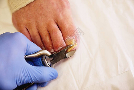 用修脚钳修剪老人脚趾甲的美甲师的特写镜头有指甲钳的图片