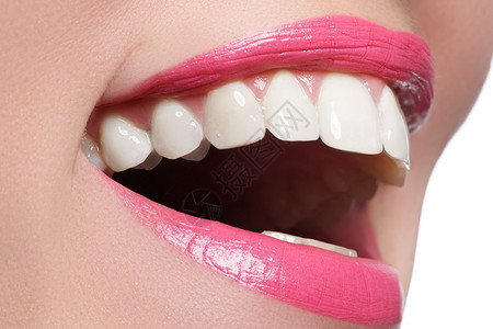 漂白后的完美笑容牙齿护理和美白牙齿女人微笑着大牙齿微笑的特写镜头与白背景图片