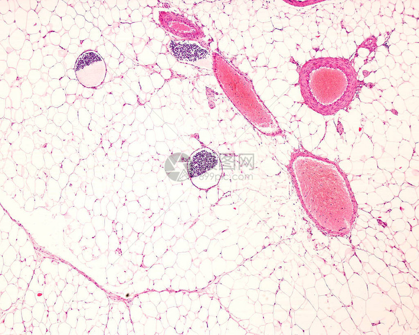 两条肌肉动脉两条静脉和三个被脂肪组织包围的淋巴管淋巴管是通过其内部的淋巴细胞来识别的光学显微镜显微照片苏木精图片