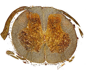 脊髓的银染横截面图片